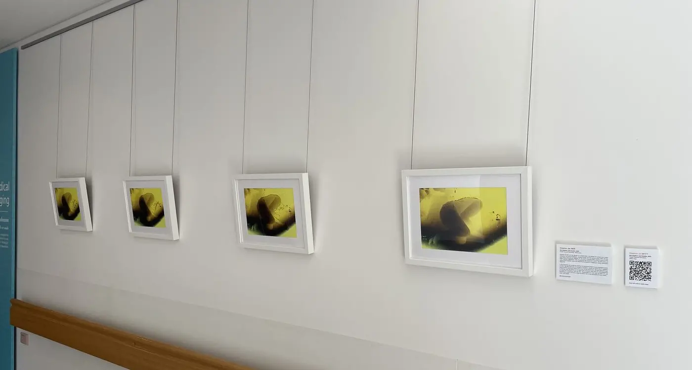 Enjoy the still or the film with new art at hospital